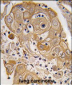 PTRF Antibody (N-term)